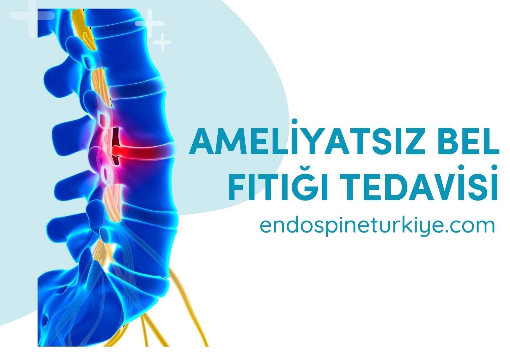 Bel fıtığı ameliyatsız tedavi yöntemleri