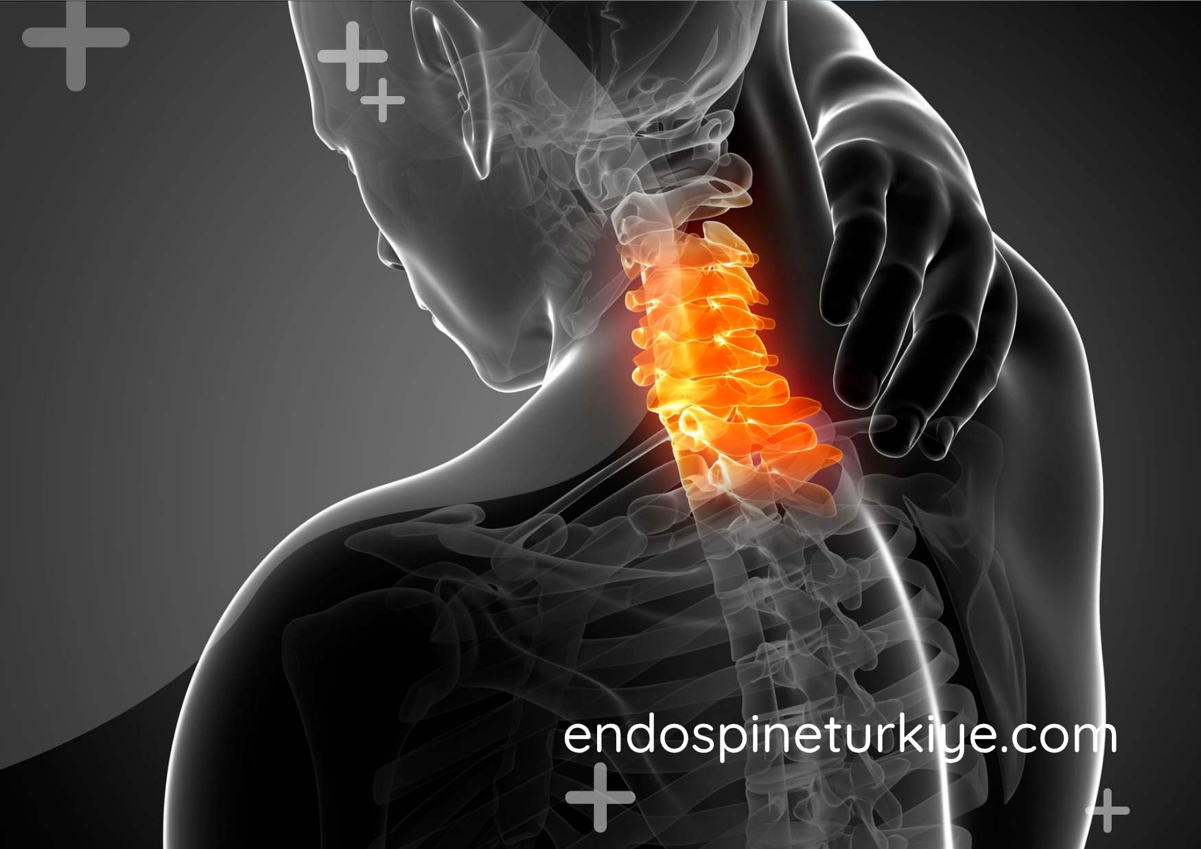 Tam kapalı endoskopik boyun fıtığı ameliyatı - disk koruyucu PECD yöntemi